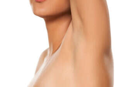 Excessive underarm sweating